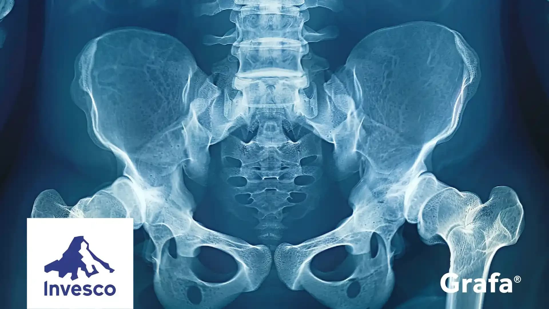 Invesco S&P SmallCap Health Care ETF primary media