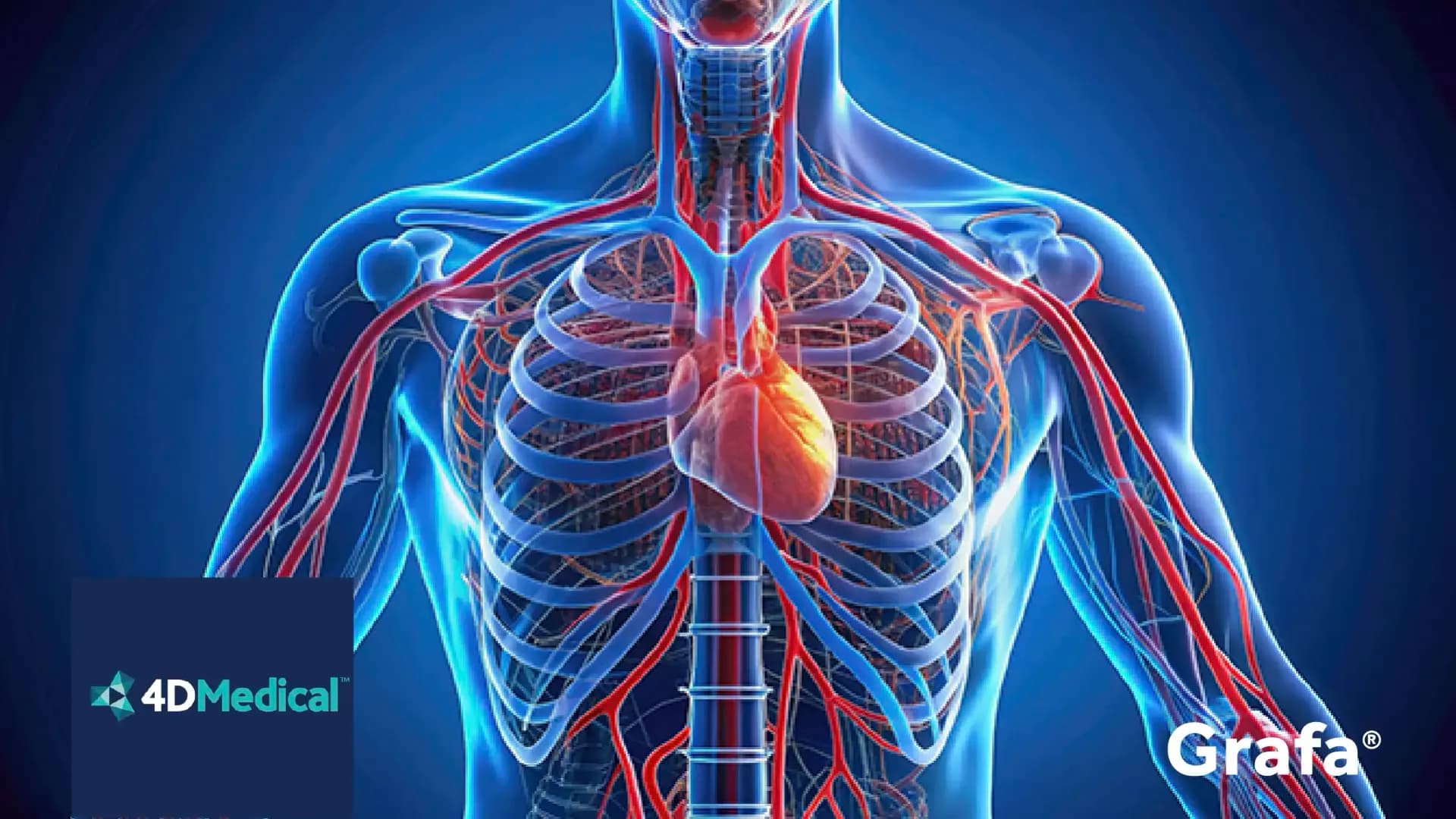 4Dmedical primary media