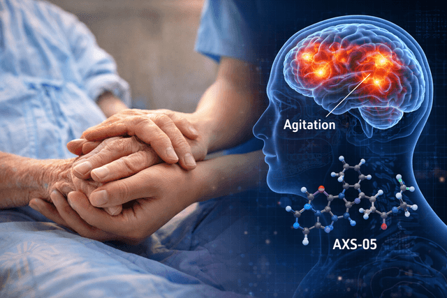 Axsome jumps as FDA grants priority review for Alzheimer’s agitation drug